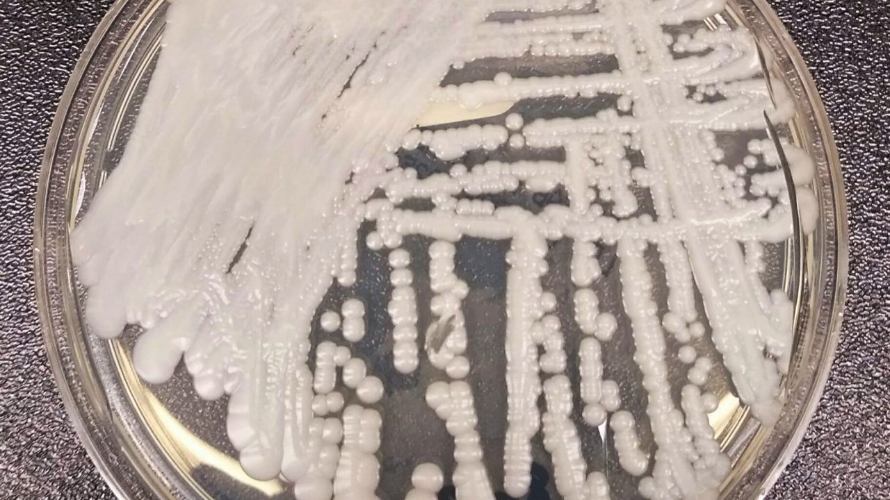 A strain of Candida auris growing in a petri dish at a CDC laboratory