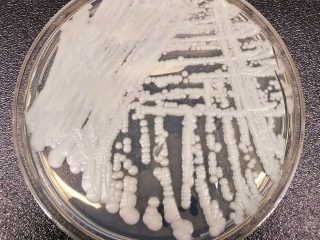 A strain of Candida auris growing in a petri dish at a CDC laboratory
